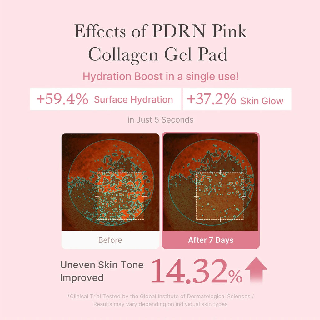 Medicube PDRN PINK COLLAGEN TONING GEL PAD 70pcs,Soft & Skin-Friendly,Soaked Essence,Ample Essence,Korean Skincare,Korean Makeup